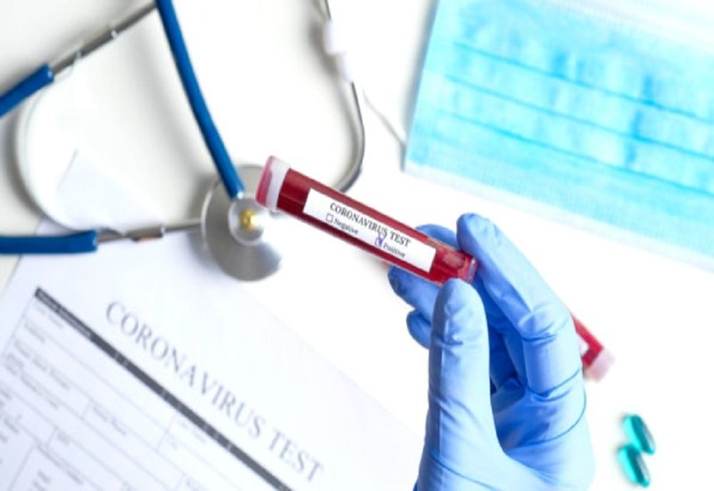 1.232 de infectări în ultimele 24 de ore și 48 de decese ale unor pacienți infectați cu noul coronavirus