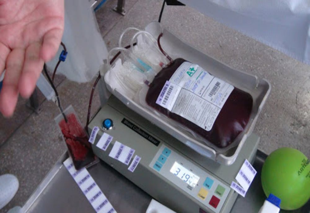 Un brailean are nevoie de sânge pentru o intervenție chirurgicală pe inimă