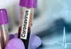 Un nou caz de coronavirus a fost depistat la Galați