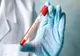 8 brăileni sunt internați la această dată în spital, confirmați cu noul coronavirus